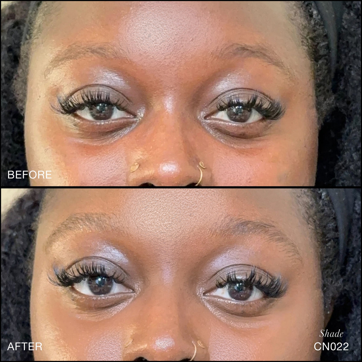 Comparaison Avant/Après d'application du Revitalize Hydra Concealer RMS Beauty, Nuance CN022. Réduction des cernes et des rougeurs pour un regard visiblement plus lisse et lumineux.