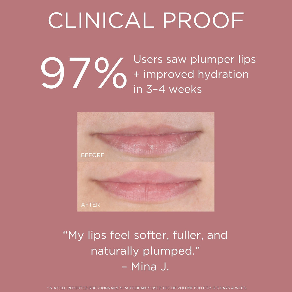 97% des utilisateurs ont remarqué plus de volume et plus d'hydratation après 3-4 semaines d'utilisation du LED lip volume pro solaris lab NY. 