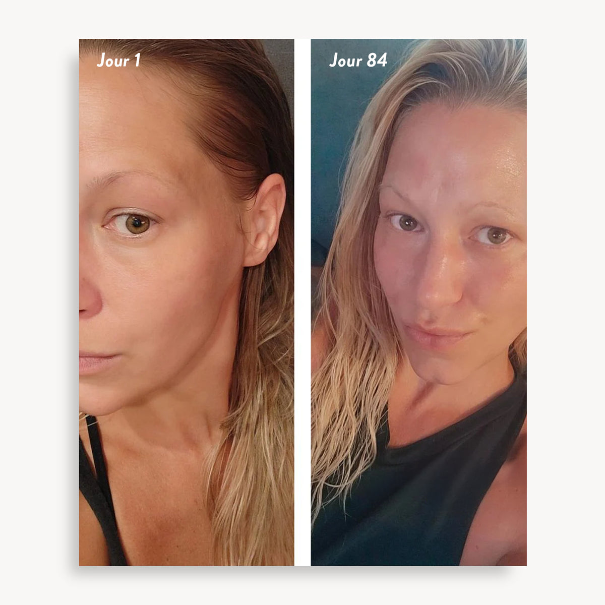 Holi (Growth) 84 Leave-in Hair Growth Scalp Spray - Agent Nateur - comparatif jour 1 et jour 84, cheveux blonds
