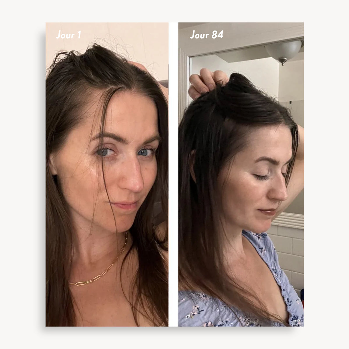 Holi (Growth) 84 Leave-in Hair Growth Scalp Spray - Agent Nateur - day 1 and day 84 comparison, brown hair roots
