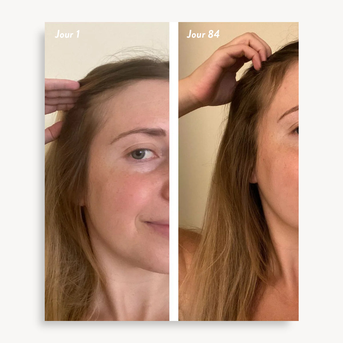 Holi (Growth) 84 Leave-in Hair Growth Scalp Spray - Agent Nateur - day 1 and day 84 comparison, light brown hair temples