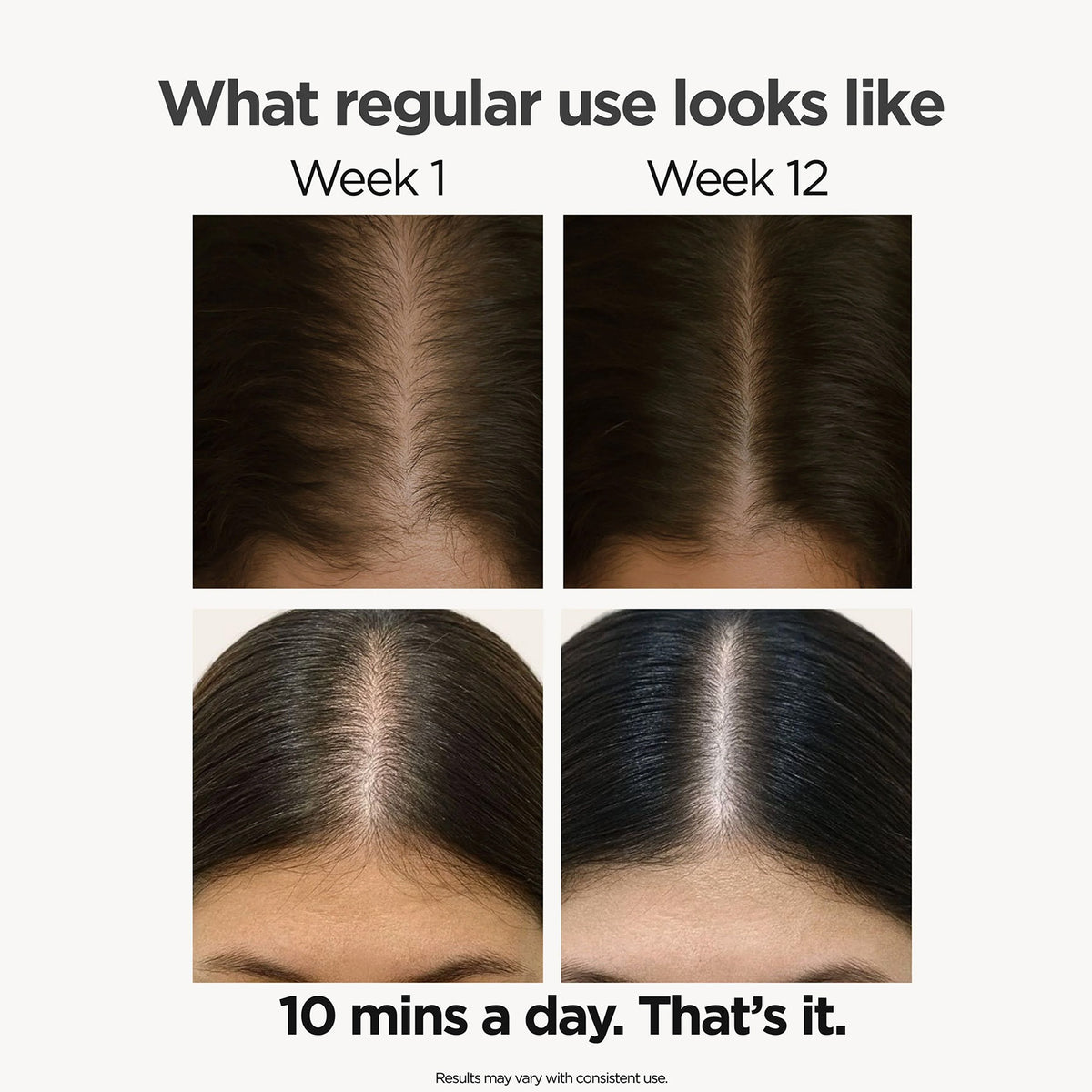 LED Hair Growth Hat PRO Supporting Growth