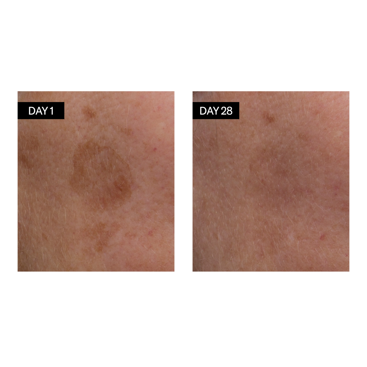 Avant / après : Sérum Eclaircissant - Vitamine C & E + Acide Hyaluronique - Odacité