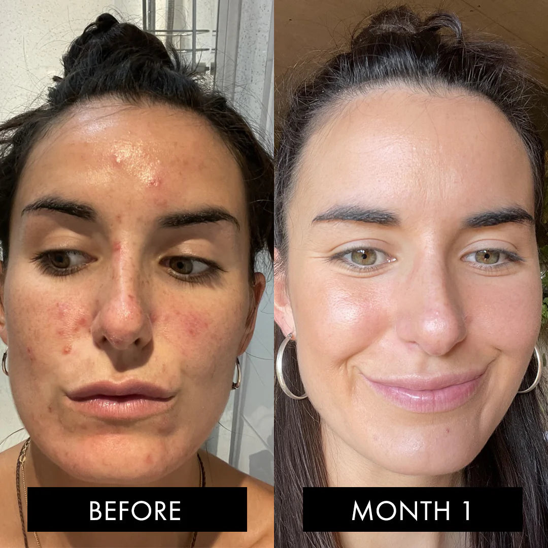 The Skin Elixir