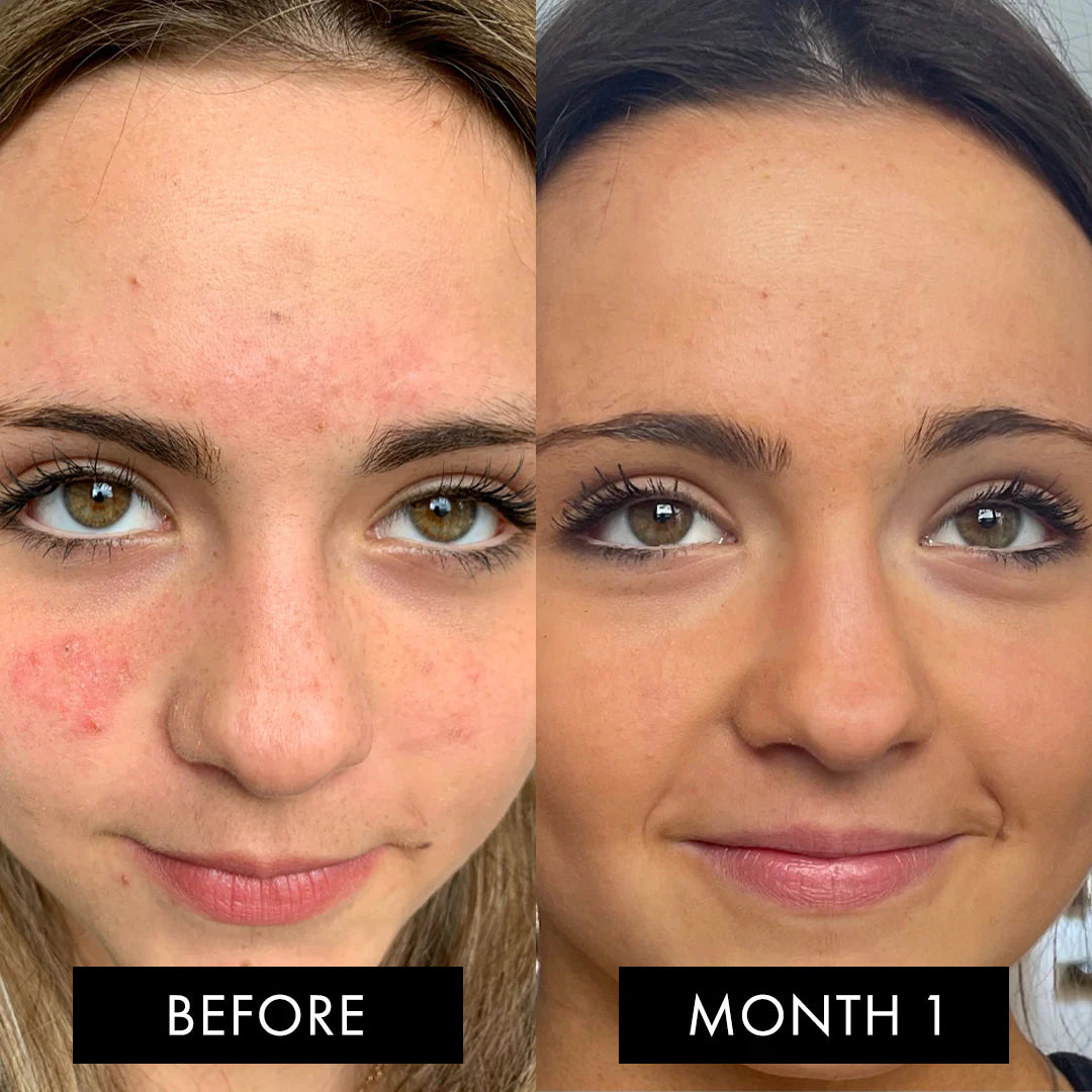 The Skin Elixir