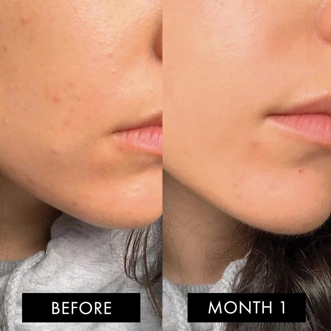 The Skin Elixir